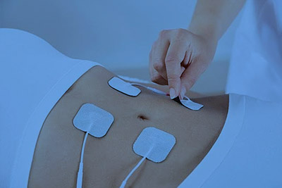 mujer recibiendo electroestimulacion  amsed veracruz